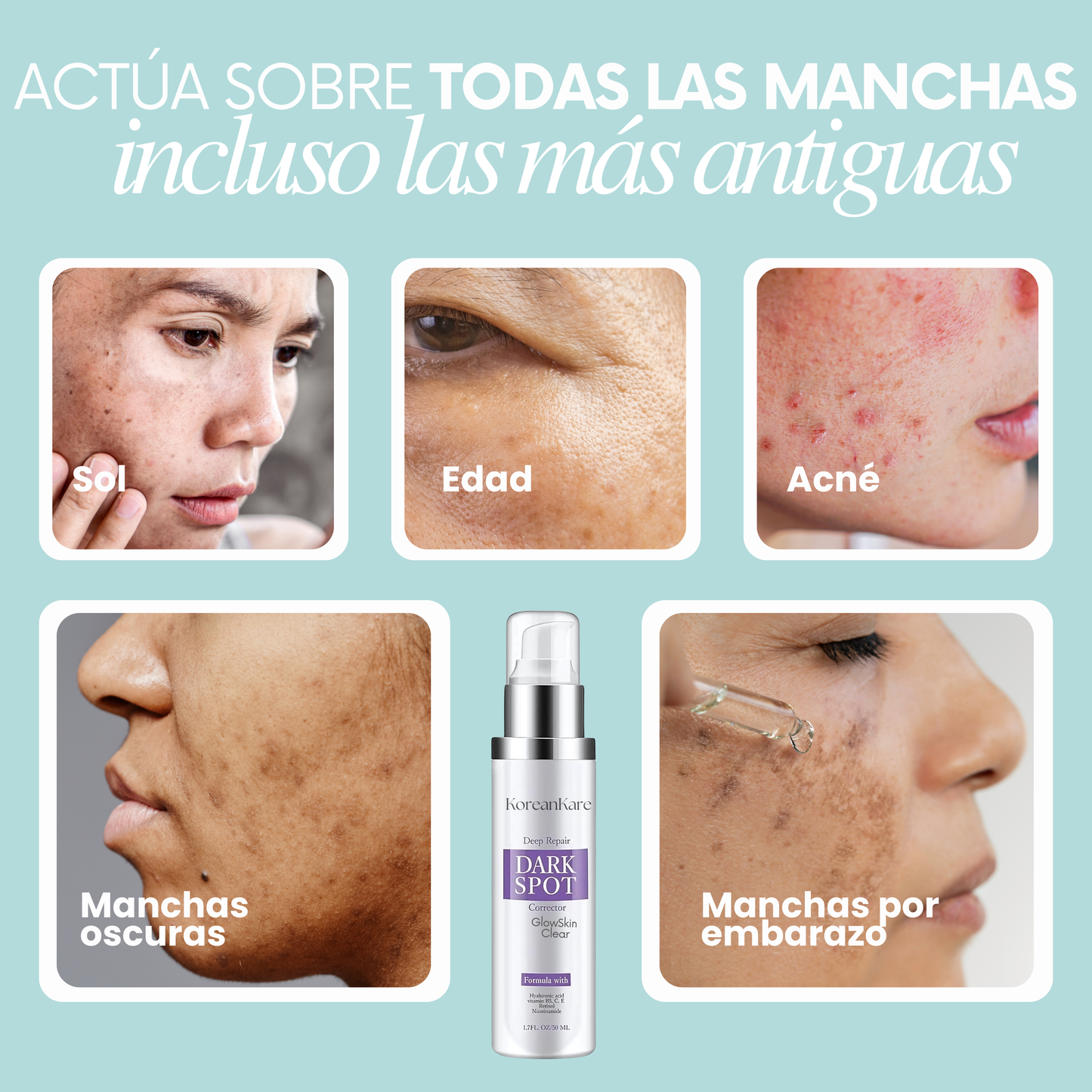 KoreanKare® Crema Antimanchas
